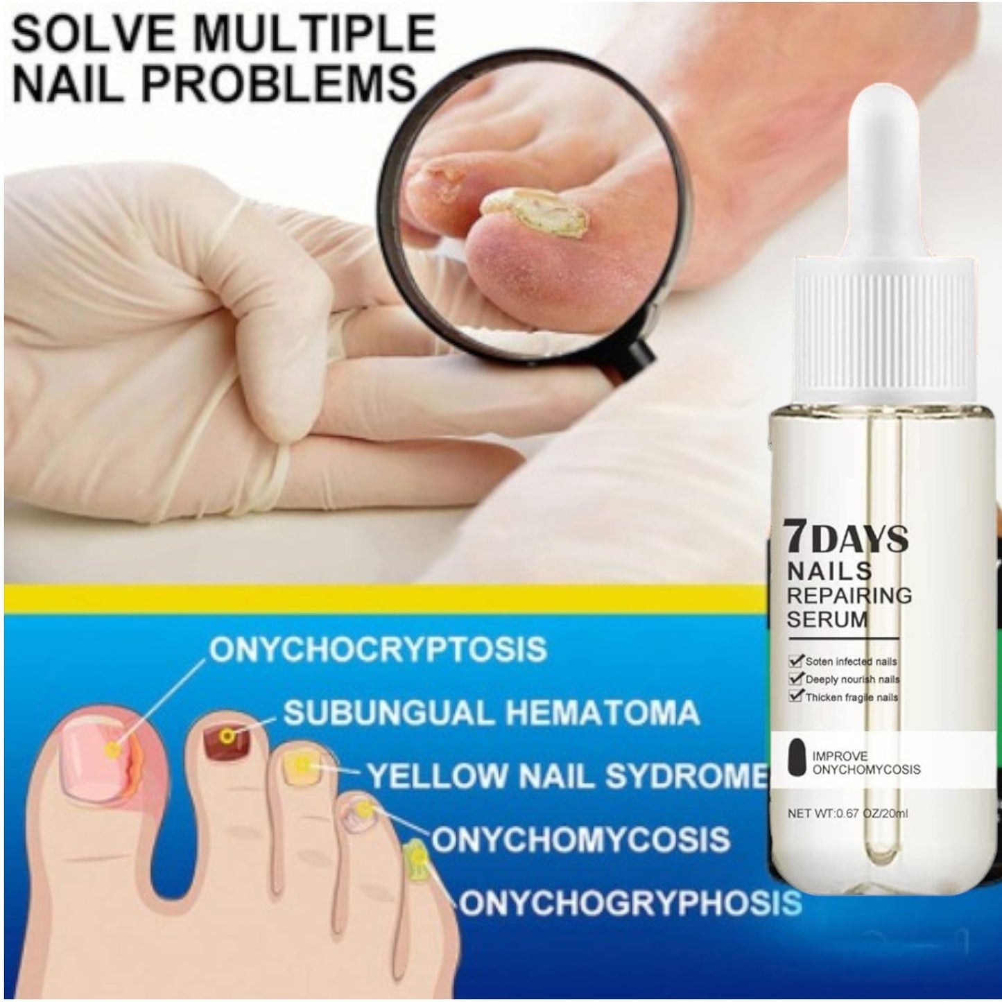 Nail Fungus Treatment Essence Serum