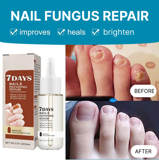 Nail Fungus Treatment Essence Serum